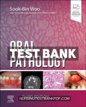 Test Bank for Oral Pathology 3rd Edition by Woo