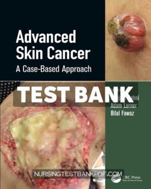 Test Bank for Advanced Skin Cancer 1st Edition by CRC Press
