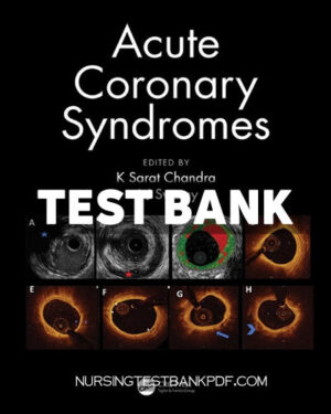 Test Bank for Acute Coronary Syndromes 1st Edition by Chandra