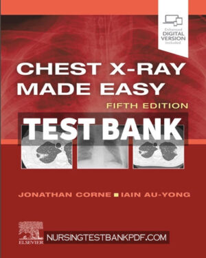 Test Bank for Chest X Ray Made Easy E Book 5th Edition by Corne