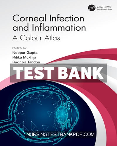 9781000377217-TEST-BANK Test Bank for Corneal Infection and Inflammation 1st Edition by CRC Press