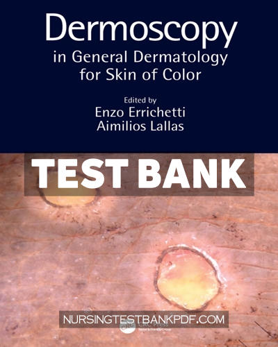 9781000434385-TEST-BANK Test Bank for Dermoscopy in General Dermatology for Skin of Color 1st Edition by CRC Press