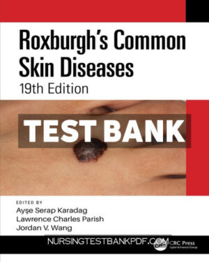 Test Bank for Roxburghs Common Skin Diseases 19th Edition by KaradaÄŸ
