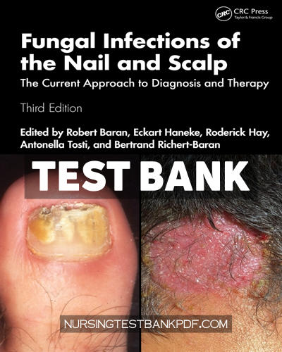 9781040145982-TEST-BANK Test Bank for Fungal Infections of the Nail and Scalp 3rd Edition by CRC Press
