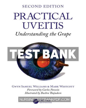 Test Bank for Practical Uveitis 2nd Edition by Williams