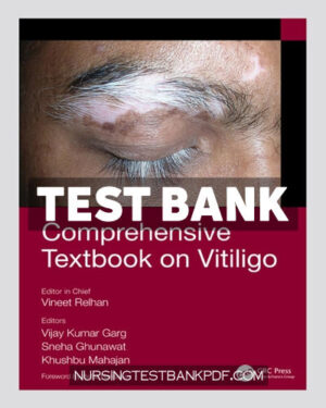 Test Bank for Comprehensive Textbook on Vitiligo 1st Edition by Ghunawat