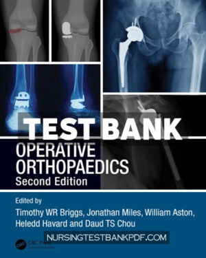 Test Bank for Operative Orthopaedics 2nd Edition by Miles