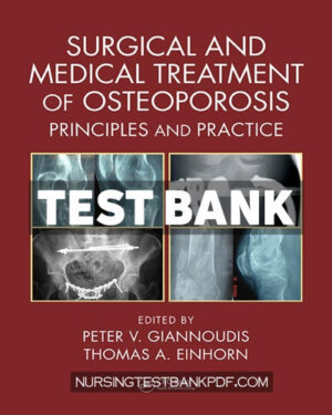Test Bank for Surgical and Medical Treatment of Osteoporosis 1st Edition by Giannoudis