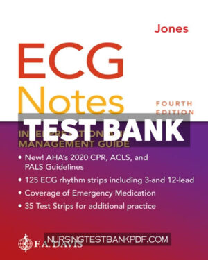 Test Bank for ECG Notes 4th Edition by Jones