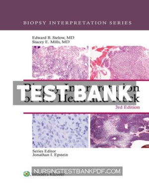 Test Bank for Biopsy Interpretation of the Head and Neck 3rd Edition by Stelow