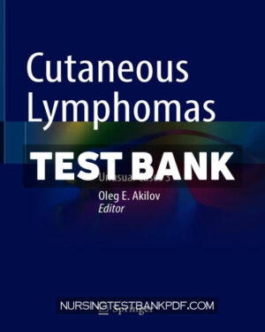 Test Bank for Cutaneous Lymphomas by Springer