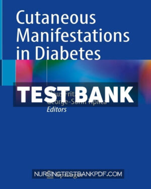 Test Bank for Cutaneous Manifestations in Diabetes by Springer